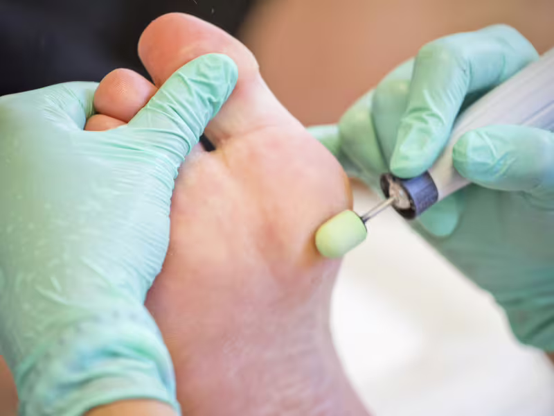 Odborné přeškolení na přístrojovou pedikúru